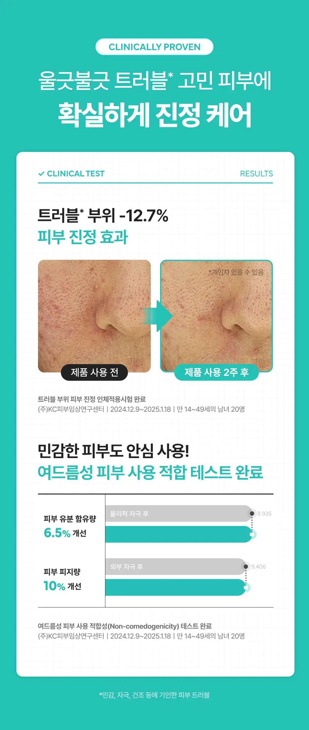 [NEW/즉각수분쿨링] 레드 블레미쉬 히알 시카 쿨링 겔 마스크 1매 상세페이지 18